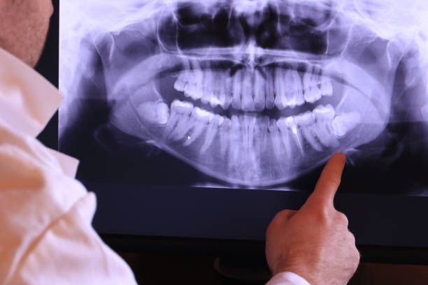 Best Emergency Tooth Extraction  in Orland Hls, IL