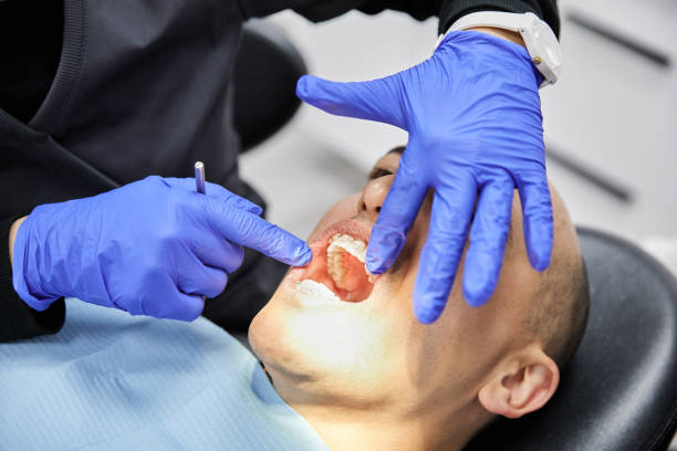 Best Teeth Whitening  in Orland Hls, IL